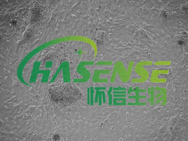II型肺泡上皮细胞