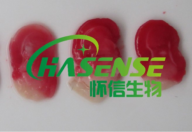 脑梗TTC染色